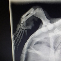 Strandings turtle xray